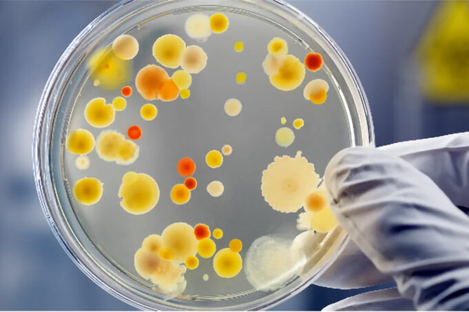 Ονοματολογία των μικροοργανισμών? Μα είναι τόσο εύκολο! πρωτοσέλιδο - Ονοματολογία των μικροοργανισμών? Μα είναι τόσο εύκολο!