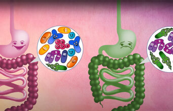 Η σύνθεση της Εντερικής Μικροχλωρίδας θα οδηγήσει στην Ευβίωση ή στην Δυσβίωση? ΠΡΩΤΟΣΕΛΙΔΟ - Η σύνθεση της Εντερικής Μικροχλωρίδας θα οδηγήσει στην Ευβίωση ή στην Δυσβίωση?