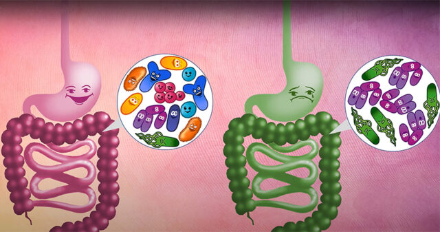 PHOTO 3.1.2.2 copy ΠΡΩΤΟΣΕΛΙΔΟ - Η σύνθεση της Εντερικής Μικροχλωρίδας θα οδηγήσει στην Ευβίωση ή στην Δυσβίωση?