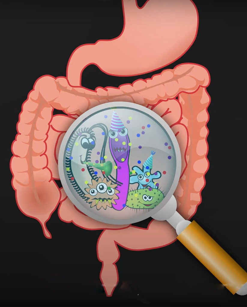 Η σύνθεση της Εντερικής Μικροχλωρίδας θα οδηγήσει στην Ευβίωση ή στην Δυσβίωση?